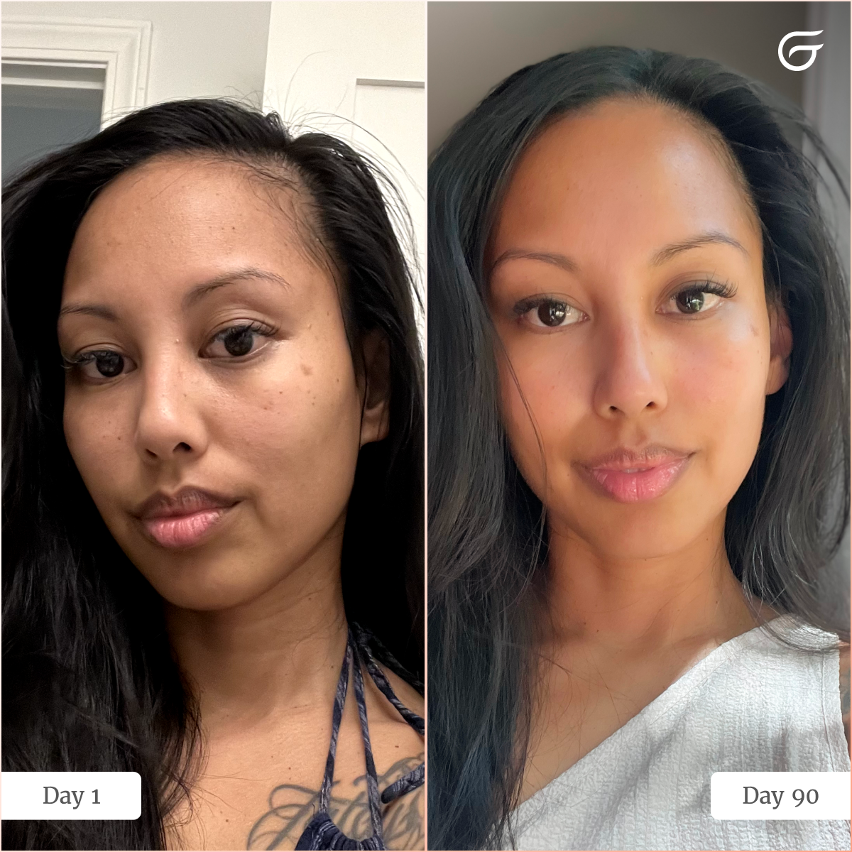 GlowUp™ LED Light Therapy Face Mask
